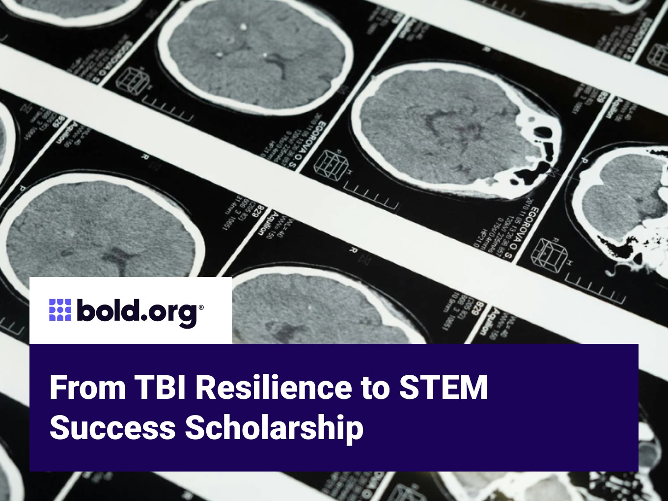 Scholarship cover image